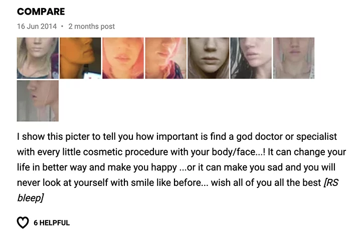 Lip lift klinika doktor Osuch opinie