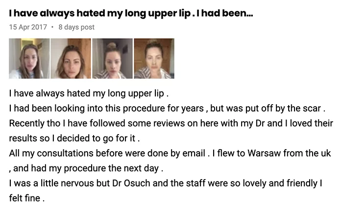 Lip lift klinika doktor Osuch opinie